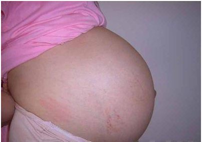 剖腹产宝宝和顺产宝宝有区别，并不是智力的高低，而是这三点