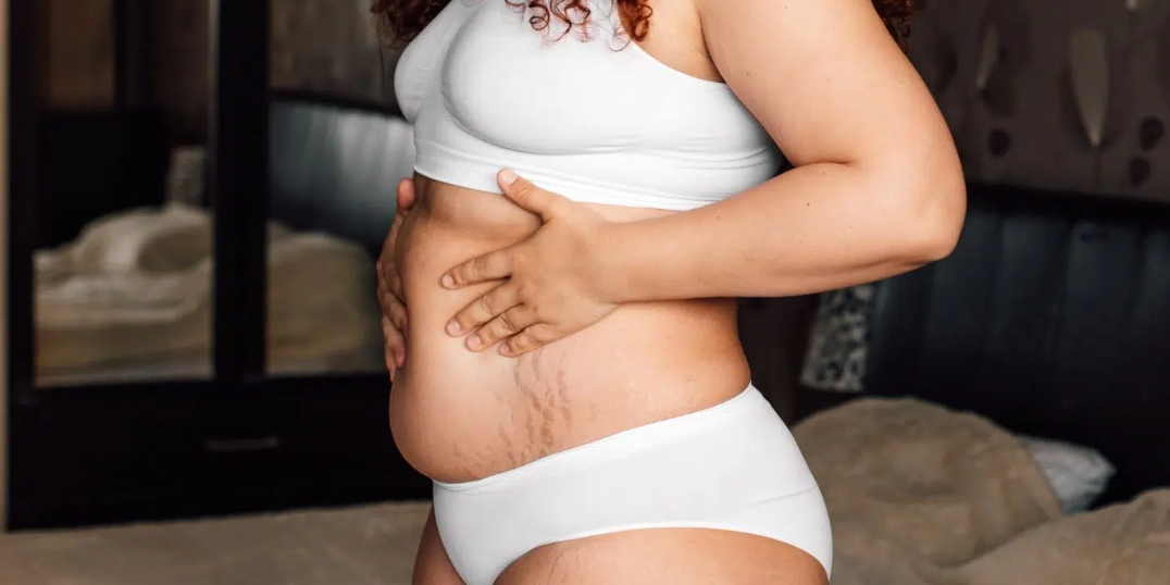 我的产后身体让我感觉不那么性感——而且我并不孤单