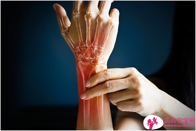 妊娠腕管综合征：如何缓解
