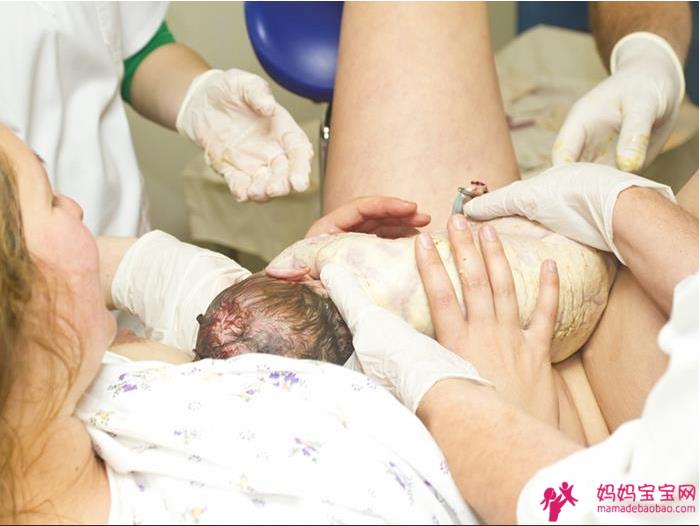 初乳怎么挤？吃到退奶食物怎么办？产后黄金哺乳期该掌握的10个母乳哺喂事项