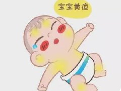 新生婴儿黄疸