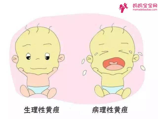 新生婴儿黄疸
