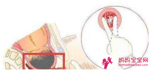 顺产过程有多少尴尬？一组图告诉你什么叫“产房无尊严”，很真实