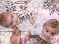 想怀二胎？怀第二胎前需知10件事