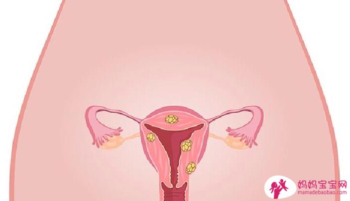 宫颈癌前病变会发展多久？癌前病变产生疼痛的原因是什么