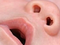 婴儿感冒怎么办