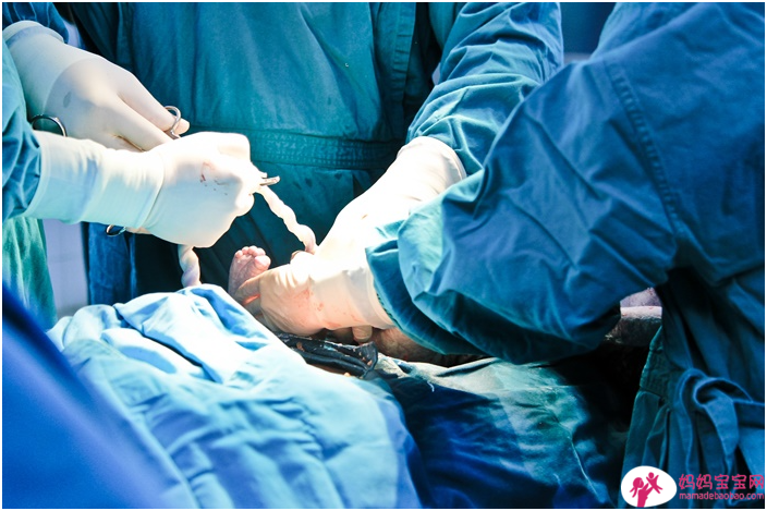 为何需要紧急剖腹产？母胎状况危急时的非常做法，抢救生命分秒必争