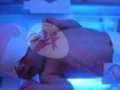 新生儿黄疸及其预防、治疗措施