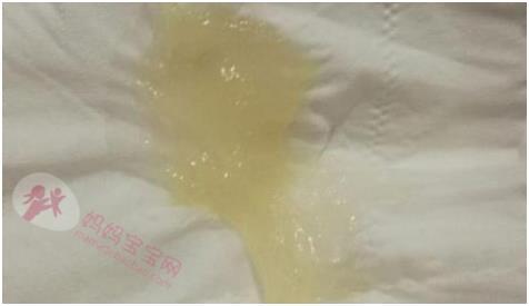 生产前，除了见红，破水，这几个“临产”症状你发现了吗？