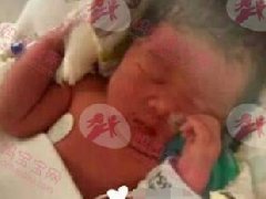 35周羊水早破，子痫并发症，早产双胞胎姐姐4.2斤，妹妹4斤