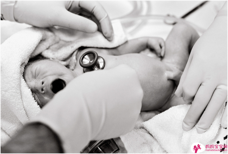 这些危险因子恐致新生儿呼吸阵喘 剖腹产也是其中之一