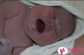 这些危险因子恐致新生儿呼吸阵喘 剖腹产也是其中之一