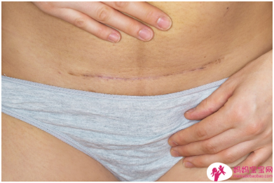 自然产还是剖腹产好呢？ 10个妳一定要知道的生产问题