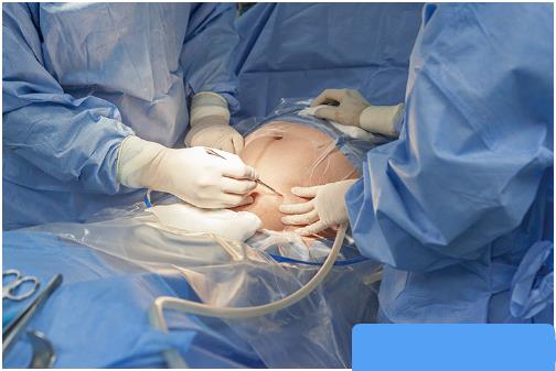 减痛分娩和麻醉何时打？自然产、剖腹产的疼痛管理有这些不同！