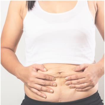 妈妈减重怎么吃？feat.功能医学科医师陈君琳