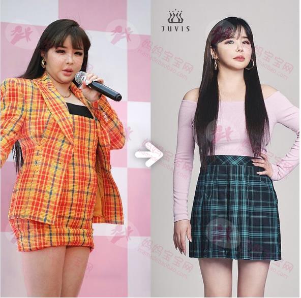 2NE1朴春「铲肉11kg又复胖」！无修片身材忽胖忽瘦引起粉丝担忧