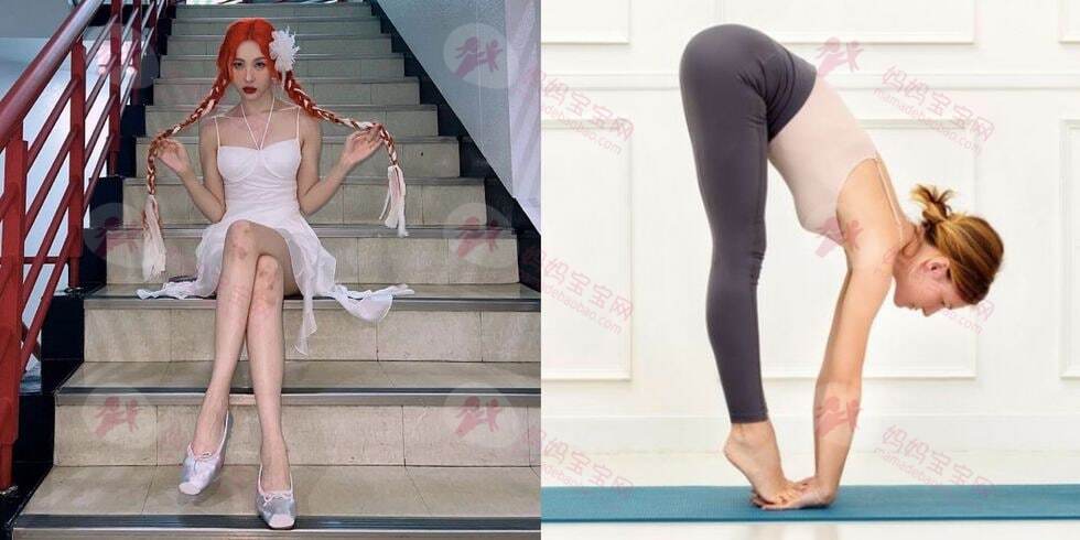 肌肉型小腿怎么瘦？ 日常可做的瘦腿习惯，每天十分钟让小腿激瘦3cm！