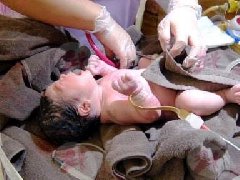 38周胎动异常急剖腹，宝宝缺氧脑病变！低温成救命关键