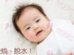 宝腹泻、发烧、脱水，家长很崩溃！预防轮状病毒该怎么做？