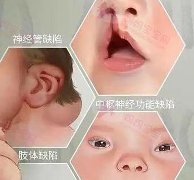 婴幼儿先天性代谢异常医：新生儿筛检不可少