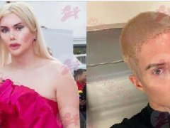 砸308万整型成韩国人！变性半年后悔：不适合当女人再变回男性