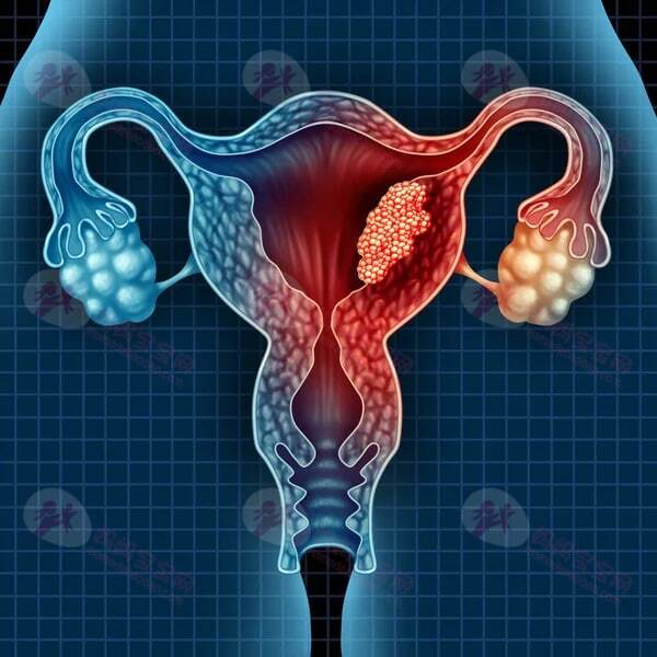 子宫内膜炎能怀上孩子吗？