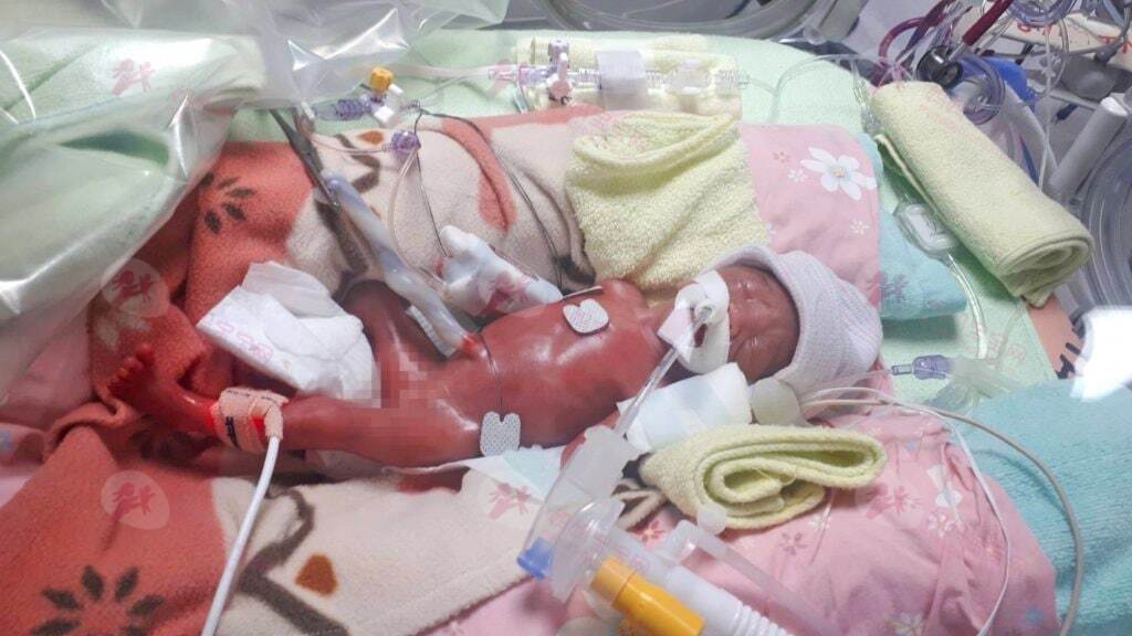 早产威胁宝宝健康协和医院专家：预防早产需做好孕期健康管理