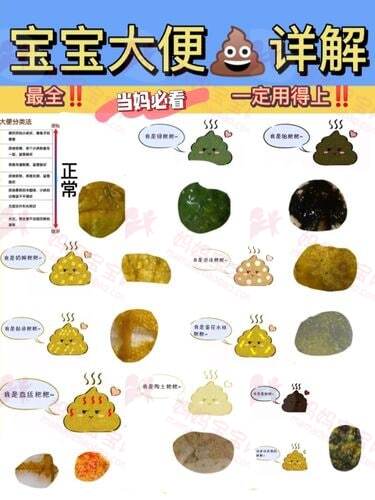 宝宝大便颜色如何辨别