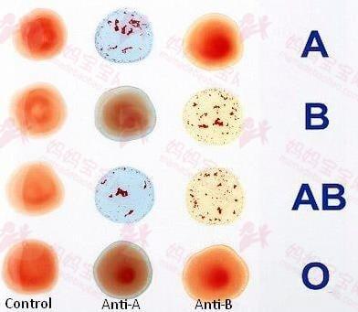 看血型就可以预测寿命长短？如果你是这两种血型，那要多留意了