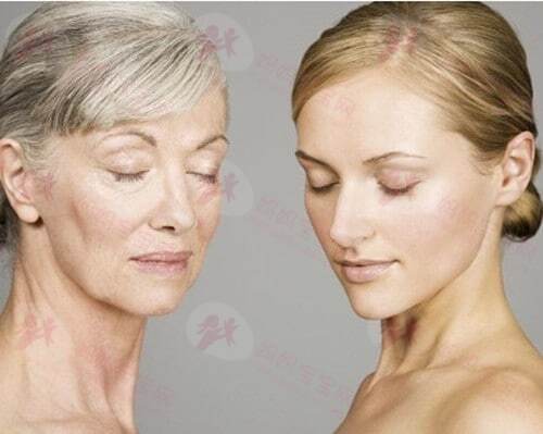 更年期综合征的主要症状有哪些呢？