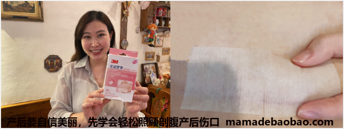 产后要自信美丽，先学会轻松照顾剖腹产后伤口