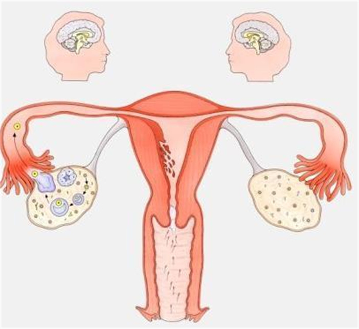 女性不孕的原因（卵巢、子宫）