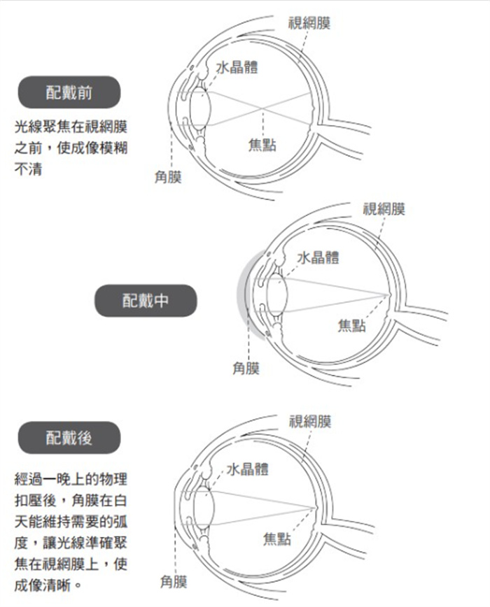 晒太阳可以减缓近视度数？孩子近视了，该如何减轻视力伤害？