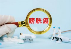 引起膀胱癌的原因有哪些