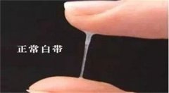 白带什么样说明怀孕了