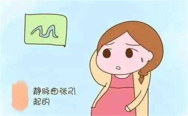 怎么能有效解决怀孕期间的静脉曲张