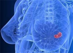 揭秘乳头痒痒：女性乳房健康的细节保卫战