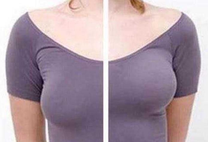 探秘哺乳后的乳房下垂：原因与缓解方法