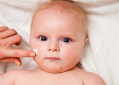 探秘新生儿湿疹的治疗方法与应对策略