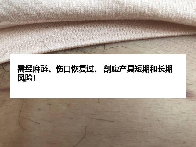 需经麻醉、伤口恢复过, 剖腹产具短期和长期风险!