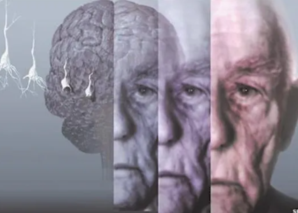 鼓鼓公开妈妈罹阿兹海默症，纪录动人故事：「就算妈妈忘了所有事，但她不会忘了爱我。」