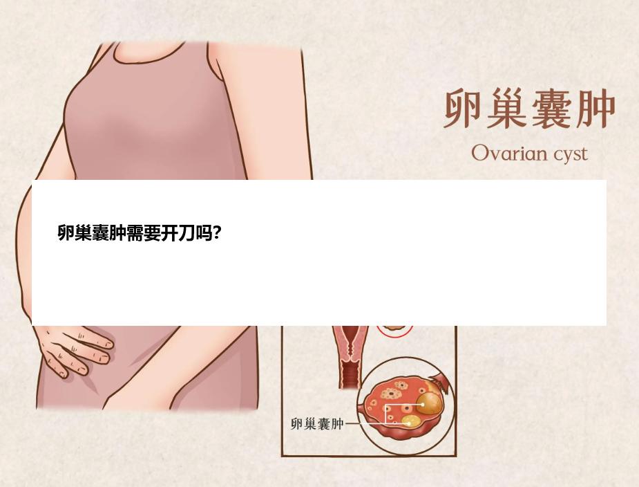 卵巢囊肿需要开刀吗？