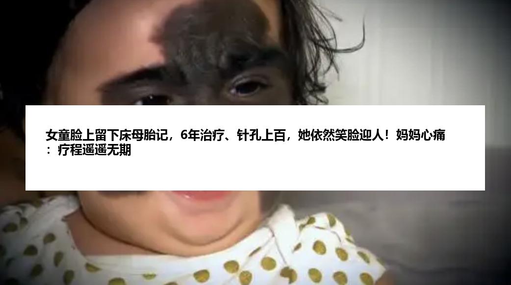 女童脸上留下床母胎记，6年治疗、针孔上百，她依然笑脸迎人！妈妈心痛：疗