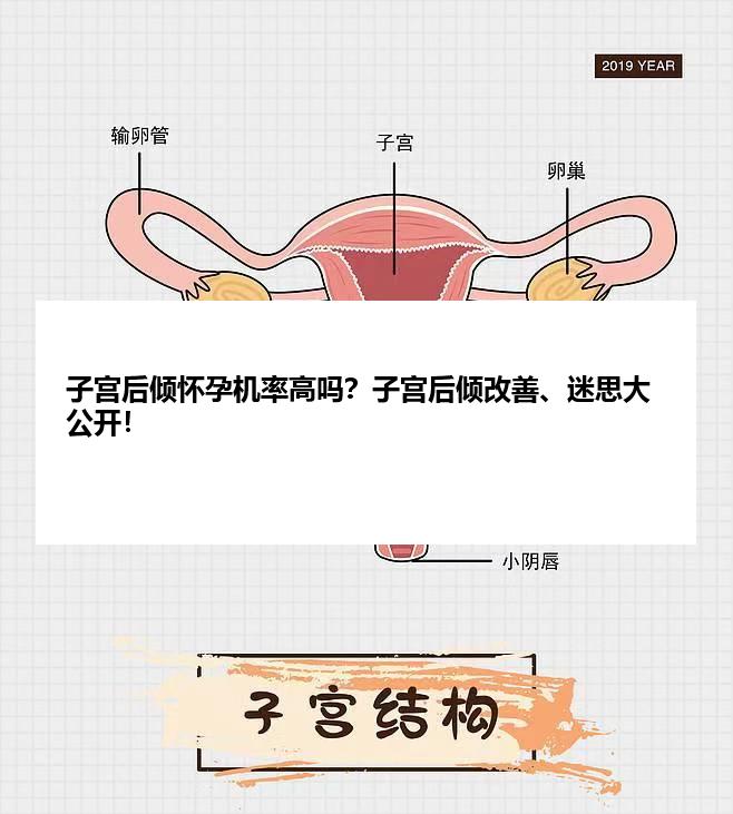 子宫后倾怀孕机率高吗？子宫后倾改善、迷思大公开！