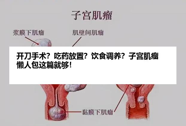 开刀手术？吃药放置？饮食调养？子宫肌瘤懒人包这篇就够！