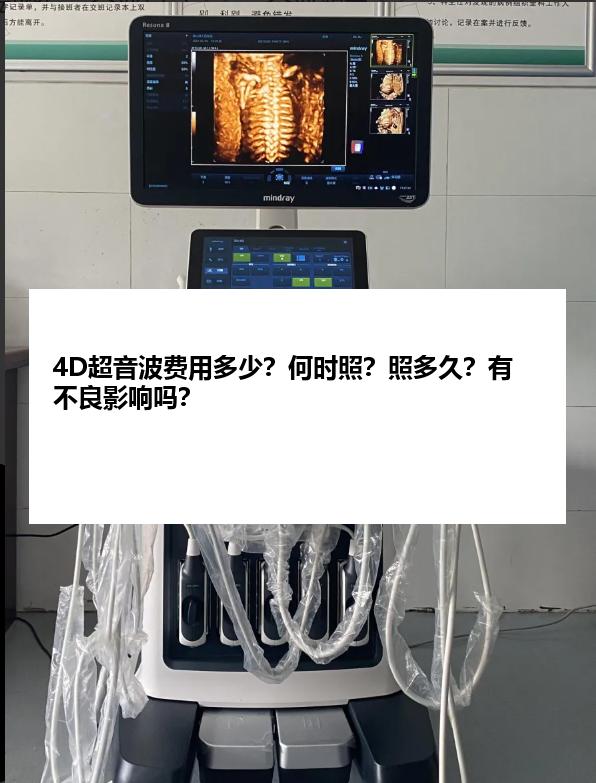 4D超音波费用多少？何时照？照多久？有不良影响吗？