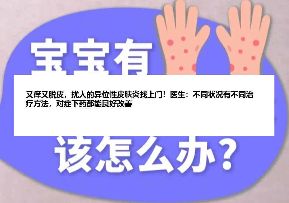 又痒又脱皮，扰人的异位性皮肤炎找上门！医生：不同状况有不同治疗方法，对症下药都能良好改善