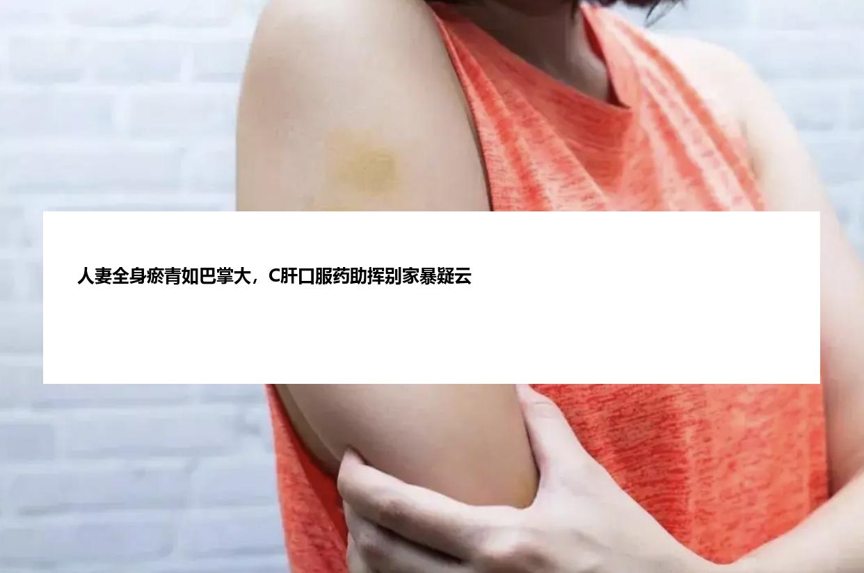 人妻全身瘀青如巴掌大，C肝口服药助挥别家暴疑云