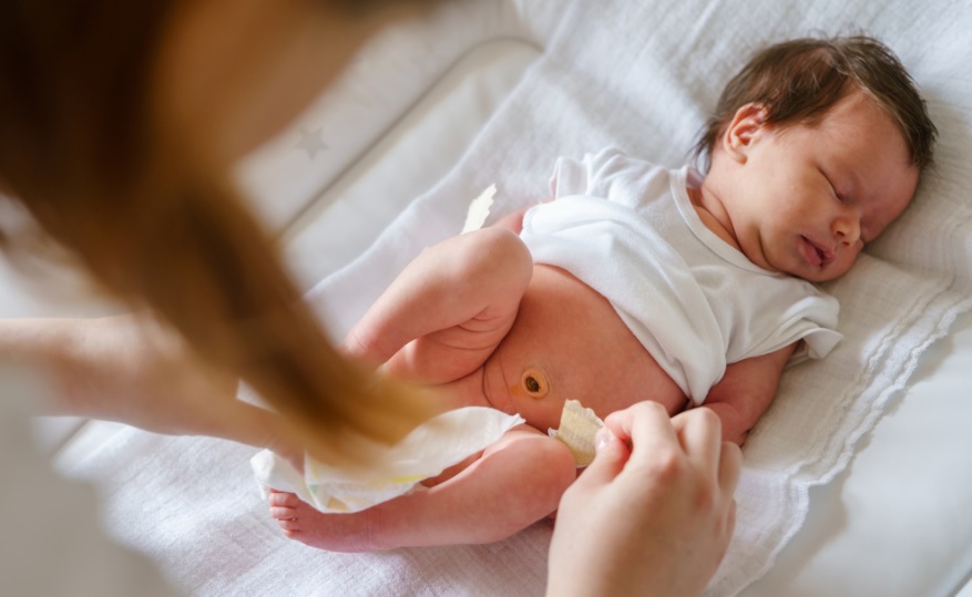 新生儿脐带颗粒肿瘤是否危险以及如何治疗