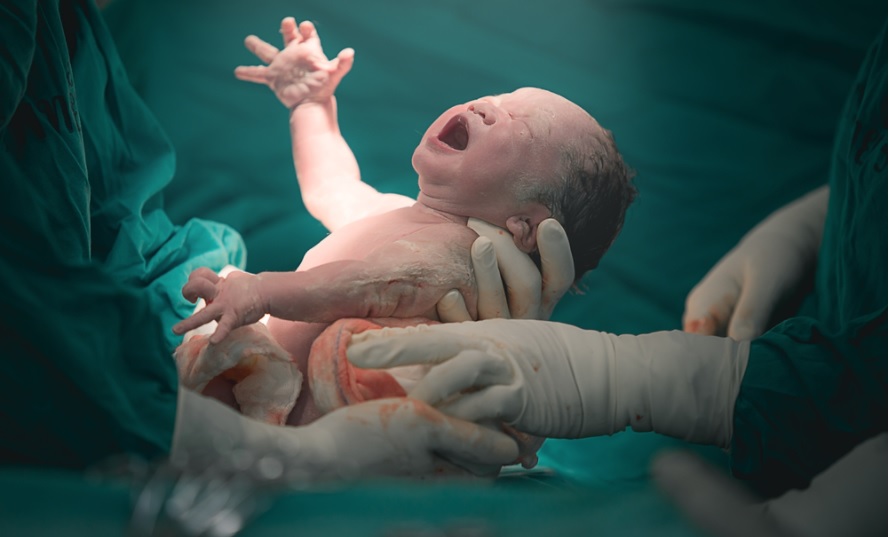 Apgar量表对婴儿的健康状况有什么看法?